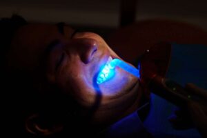 Laser Dentistry