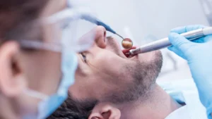 Understanding Sinus Lifting: When and Why, It’s Needed for Dental Implants