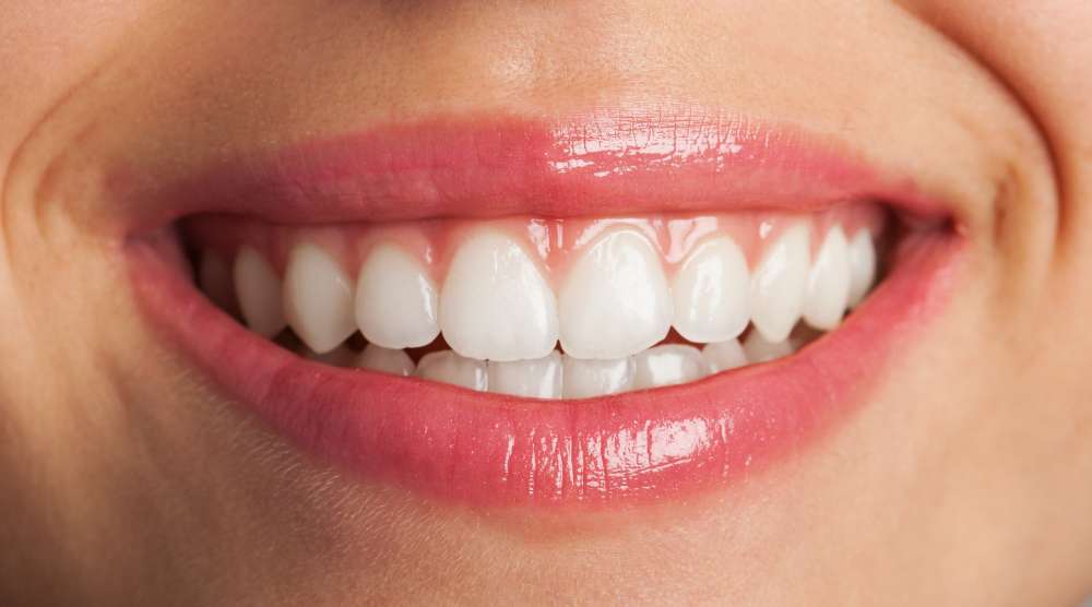 Hollywood Smile