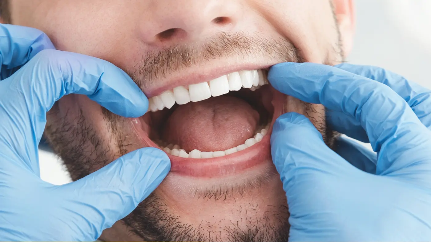 Кариес | Cavity