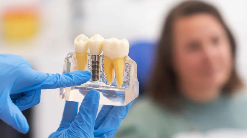 Циркониевые | Zirconia Titanium Implants